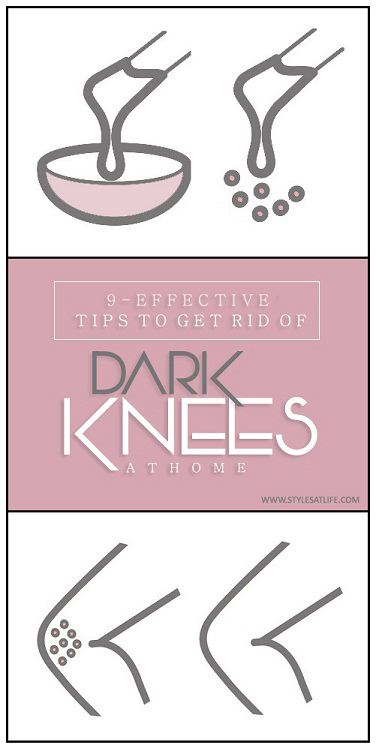 9 Effective Tips to Get Rid of Dark Knees at Home
