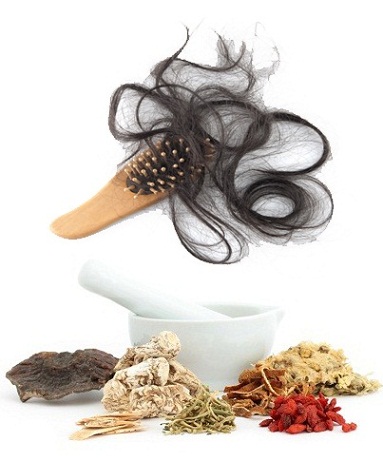 6 Effective Chinese Herbs for Hair Loss