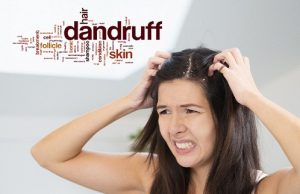 10 Best Medicines for Dandruff in India