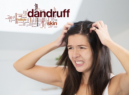 10 Best Medicines for Dandruff in India