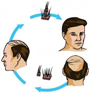 9 Best Hair Transplant Centers In Lucknow