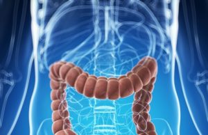 Causes And Symptoms Of Colon Cancer
